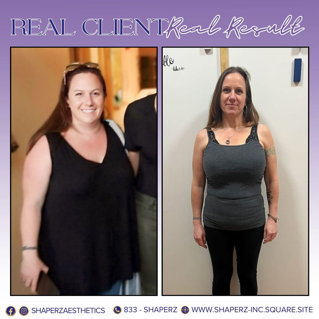 Medical weight loss before and after, real client result, at Shaperz Elite Wellness in Chicago
