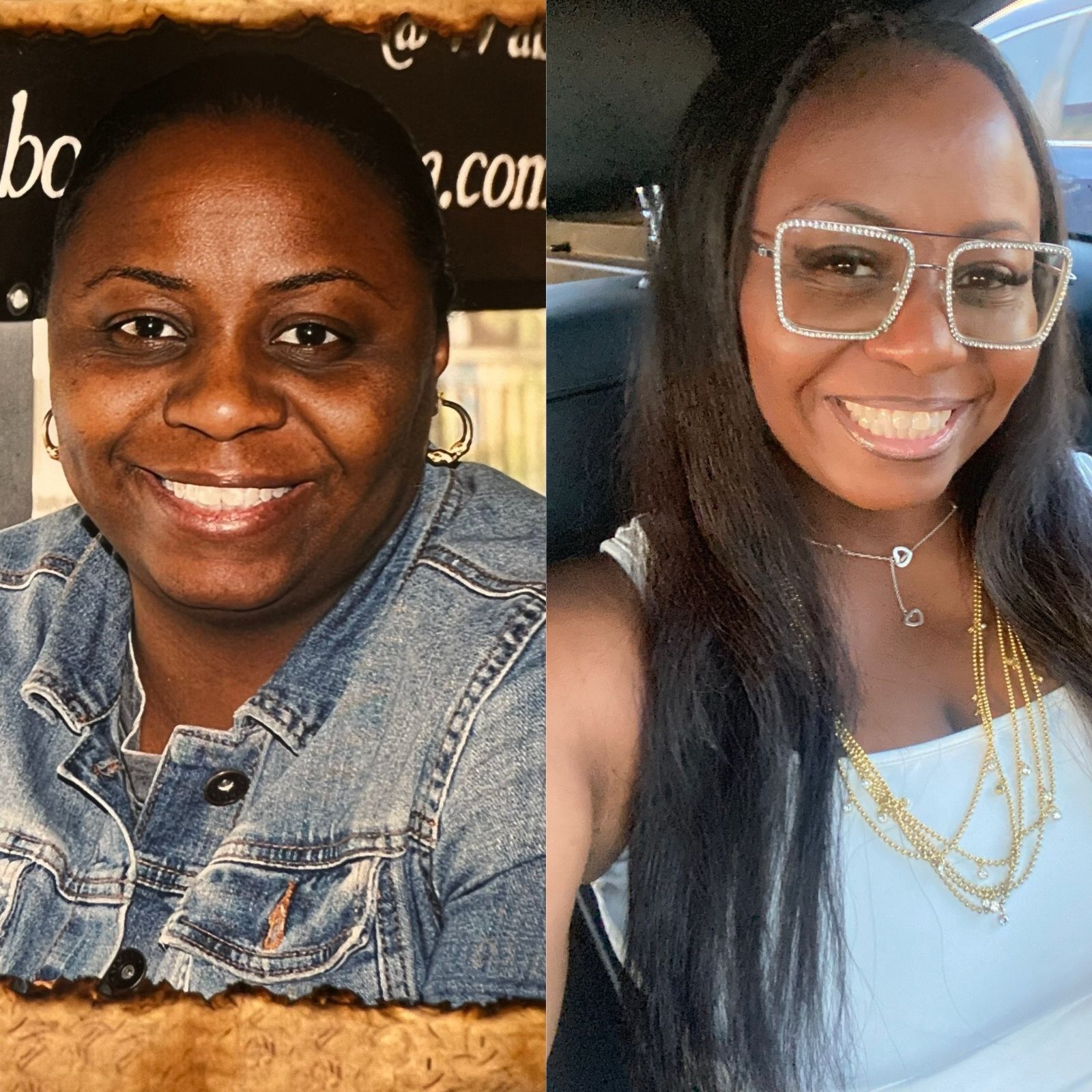 Lynn's before and after results from medical weight loss, injectable treatment and facials at Shaperz Elite Wellness in Chicago