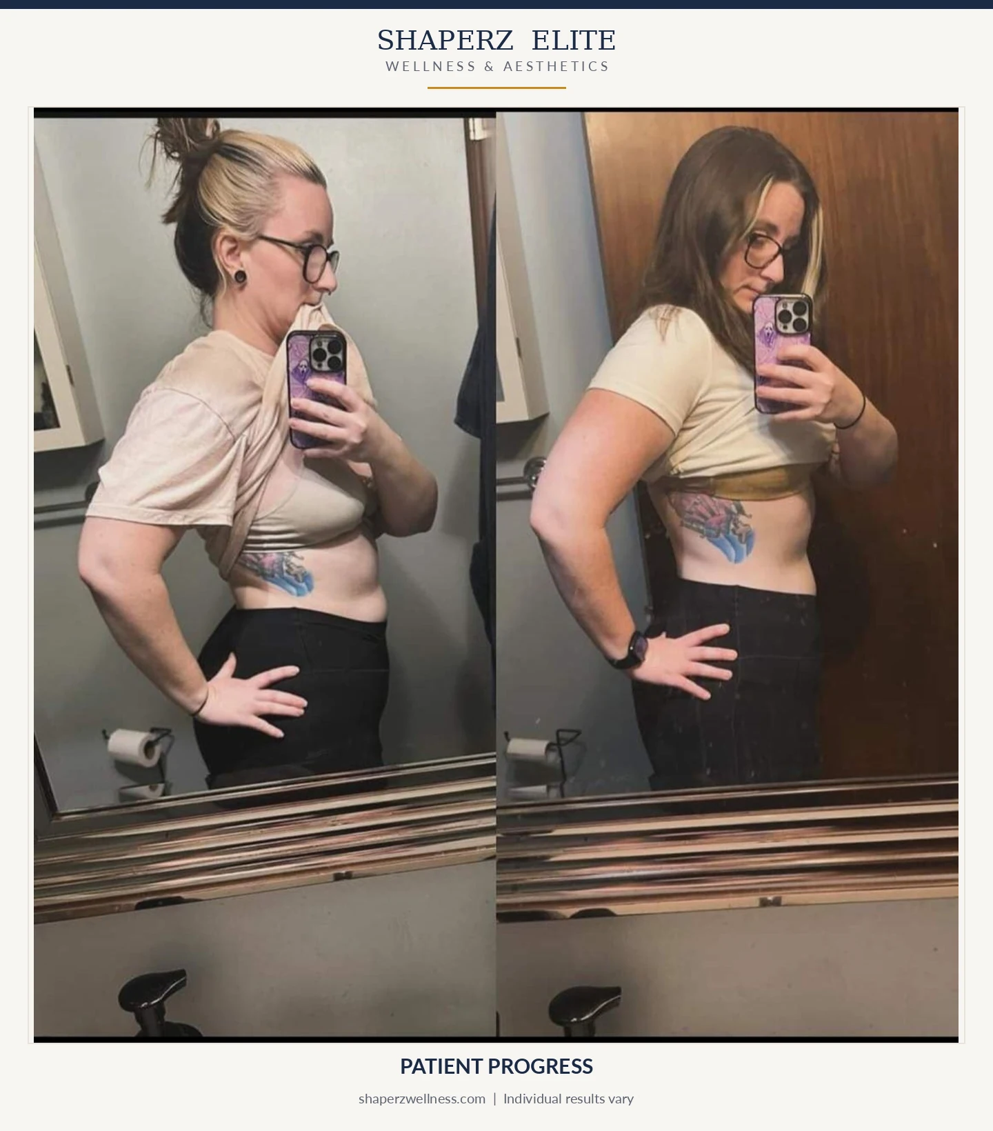 Medical weight loss patient progress, side view, at Shaperz Elite Wellness in Chicago