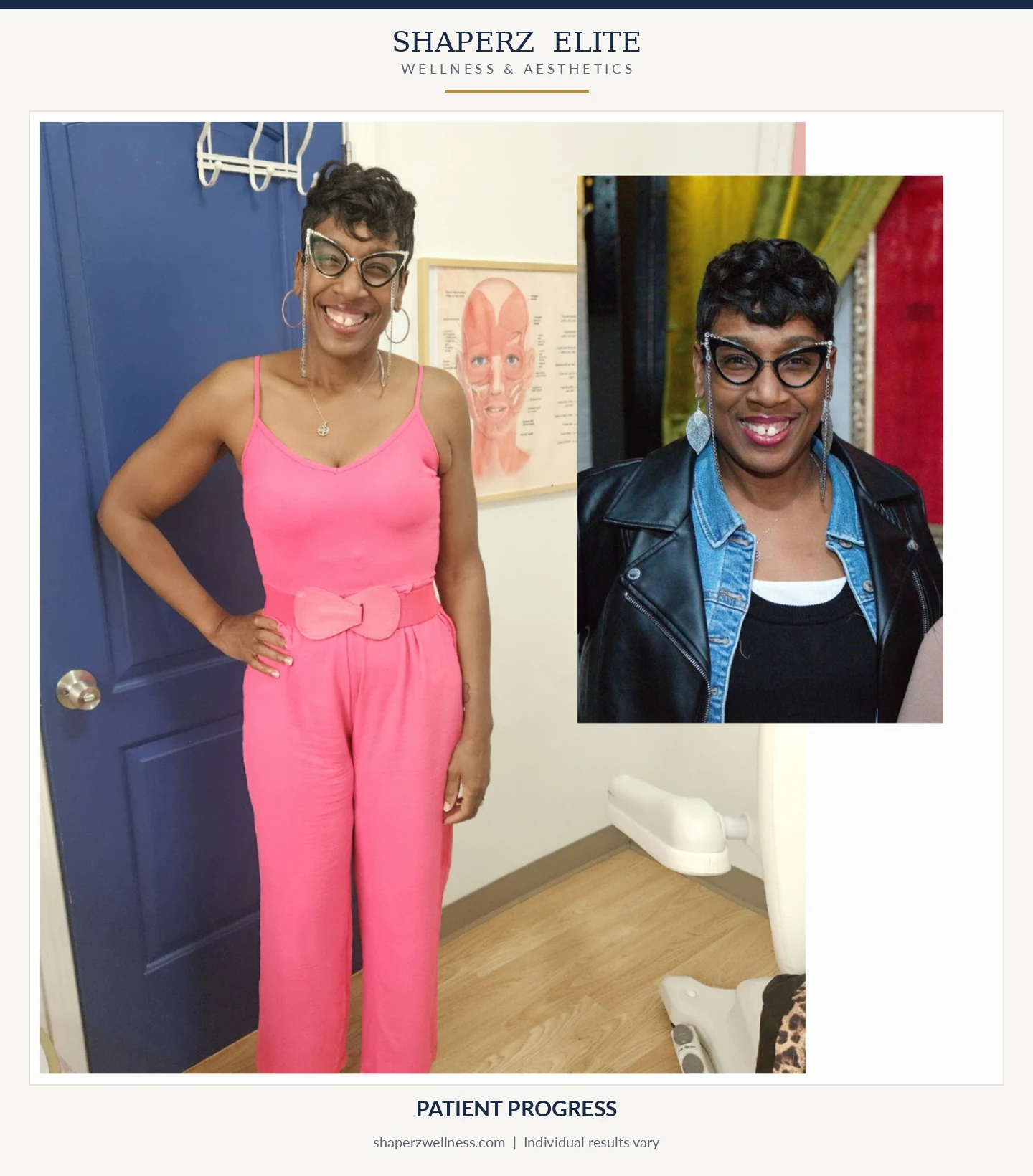 Medical weight loss patient progress at Shaperz Elite Wellness in Chicago
