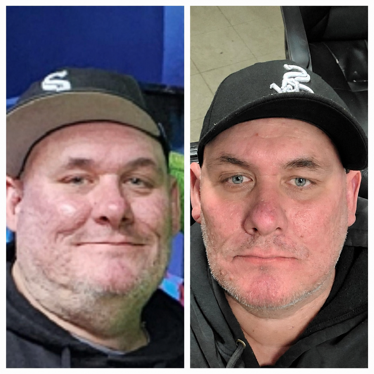 Medical weight loss before and after, client face comparison, at Shaperz Elite Wellness in Chicago