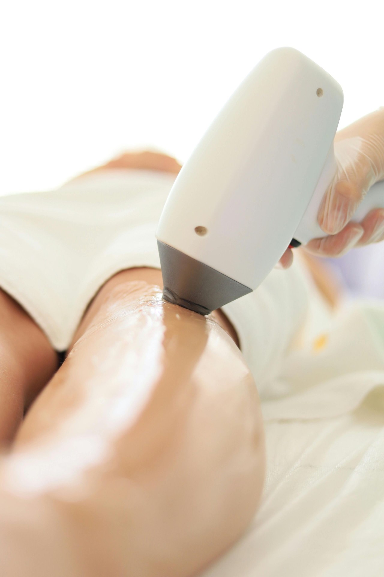 Laser treatment being performed in a professional treatment room